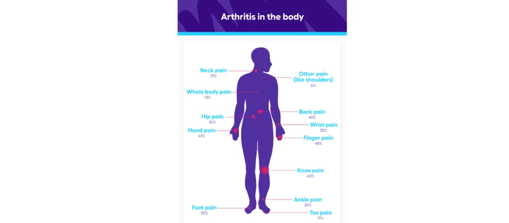 rheumatoid-arthritis-treatment